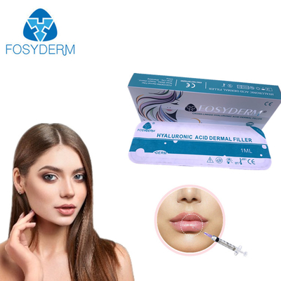 Fosyderm CE Hyaluronik Asit Çapraz Bağlantılı Dermal Dolgu, Dudaklar İçin 24mg / Ml