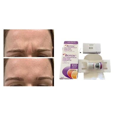 Beyaz Allergan Botulinum Toksin Yaşlanma Karşıtı  Enjeksiyonu