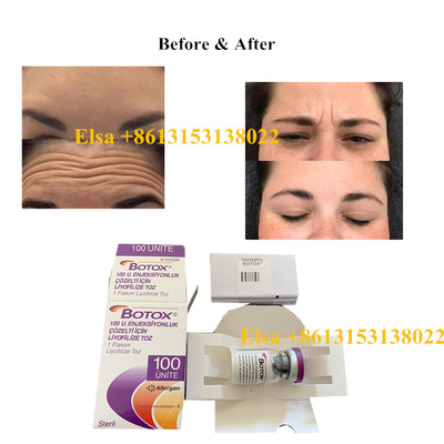 Enjeksiyon Allergan Botulinum Toksin Tip A 100 ünite Yaşlanma Karşıtı