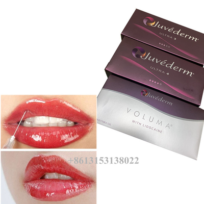 Juvederm Voluma Hyaluronik Asit Dermal Filler Gel 24mg/Ml Dermal Fillers