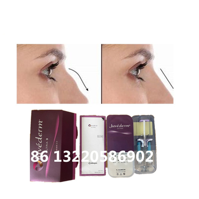Juvederm Ultra3 Ultra4 Voluma Burun Dolgusu Hyaluronik Asit Dermal