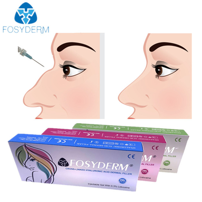 Kadın Kullanımı İçin Hyaluronik Asit Dermal Burun Dolgu Enjeksiyonu 1ml 2ml