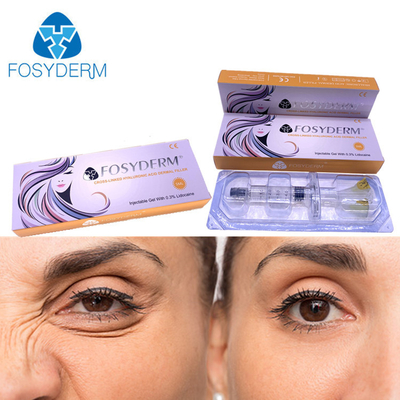 Dudak Burun İçin 5ml Hyaluronik Asit Fosyderm Dermal Dolgu Enjeksiyonu