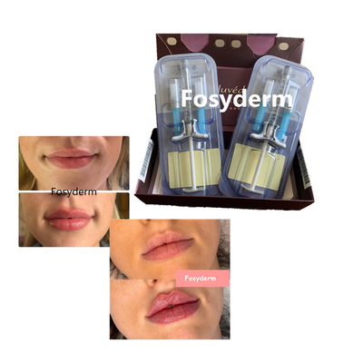 Juvederm volbella Hyaluronik Asit Dudak Dolgusu Çapraz Bağlantılı 24mg