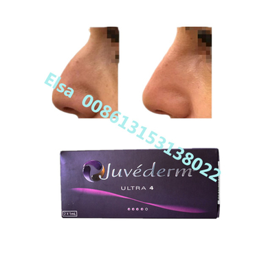 Juvederm Sodyum Ultra4 Döllenmiş Dermi Dolgu Dudak Çene Büyütme için