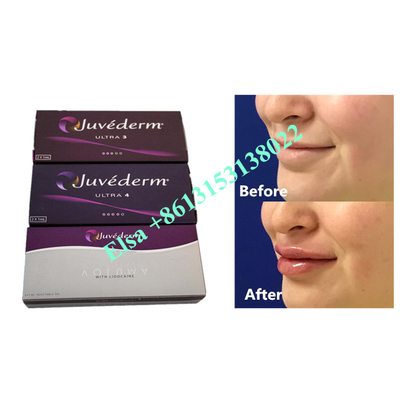 Voluma Hyaluronik Asit Fosyderm Dermal Dolgu Enjeksiyonu 24mg/Ml