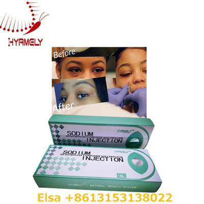 1 Ml Sodyum Hyaluronat Jel Anti Koyu Halkalar Gözler İçin Dermal Dolgu