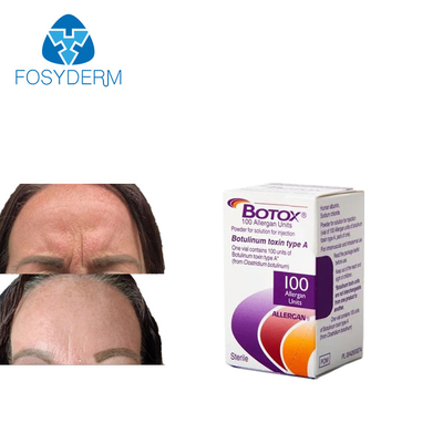 Kırışıklık Karşıtı  De Allergan 100 Ünite Enjeksiyon
