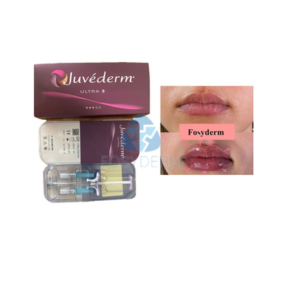Dudak Geliştirme İçin Voluma Hyaluronik Asit Dermal Filler Fosyderm