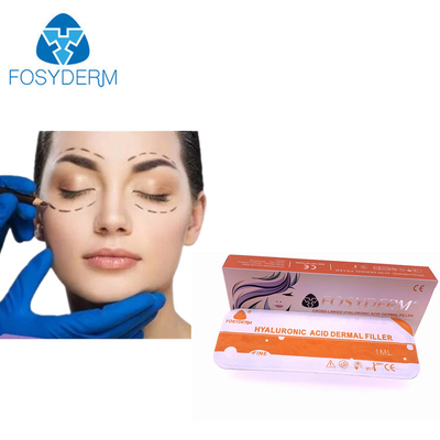 Kozmetik Enjeksiyon İçin Uzun Ömürlü Fosyderm Hyaluronik Asit Dermal Dolgu