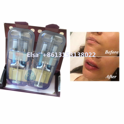 Güzellik ürünü Juvederm Voluma Hyaluronik Asit Yüz Doldurucu HA Enjeksiyonu