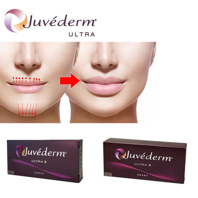 Dudaklar için Juvederm Ultra3 Hyaluronik Asit Doldurucu Dermal Enjeksiyon Gel Ön Doldurma