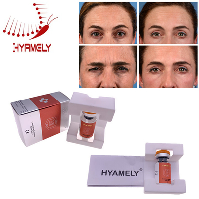 Kore Malzemeleri Yüz Kırışıklıkları İçin Hyamely  Botulinum Toksin Enjeksiyonu