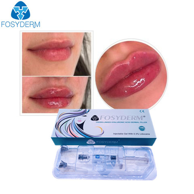 Fosyderm Hyaluronik Asit Jel Anti Yüz Kırışıklıkları Dermal Dolgu Enjeksiyonu