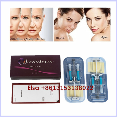 Estetik Ürünler Juvederm Ultra3 Ultra4 Voluma Hyaluronik Asit Dermal Dolgu Jel Enjeksiyonu