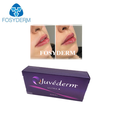 Koreli Hiyaluronik Asit Çapraz Bağlantılı Dermal Dolgu Juvederm Dudak Dolgu Enjeksiyonları