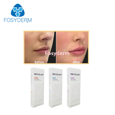 1.1 ml Dermal Lip Fillers Revolax Anti- kırışıklık için ince derin Sub-Q Hyaluronik Asit Enjeksiyonu