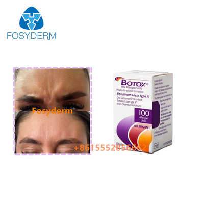 Kırışıklıkları kaldırın Enjeksiyon Allergan Botulinum Toksin  Tip A 100birim