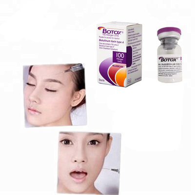 Botulinum toksin 100iu 200iu Allergan botoks tozu enjeksiyon Botulax