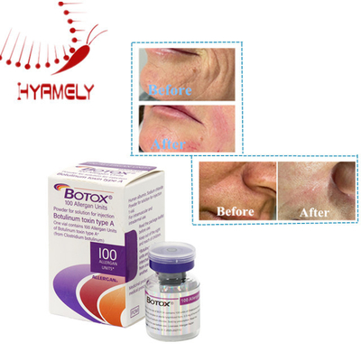 Kırışıklık çıkarma allergan botulinum toksin tipi 100 birim