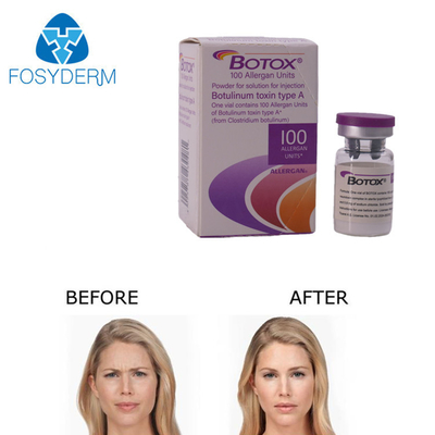 Allergan Botox Enjeksiyon 100 Birim kırışıklığı kaldırmak için
