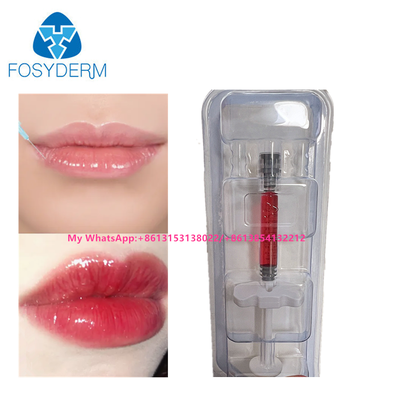 Kırmızı Dudak Doldurucu Hyaluronik Asit Deri Doldurucu Vitamin B12 Dudak için Enjeksiyon 1ml