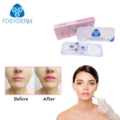Çapraz Bağlı Enjeksiyon Jeli Hyaluronik Asit Dermal Filler Yaşlanma Karşıtı CE ISO