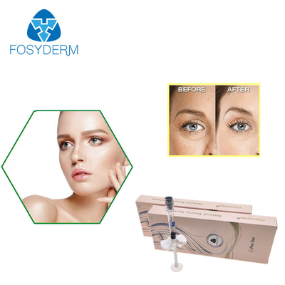 Göz Kırışıklıkları İçin Fosyderm Çapraz Bağlantılı HA Dolgu 2ml İnce Çizgi Hyaluronik Asit