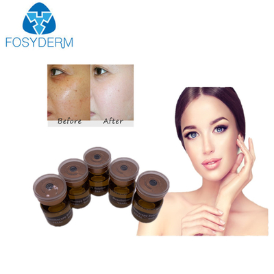 20mg / ml 5ml Mezoterapi Serumu Beyazlatıcı Mezo Solüsyonu