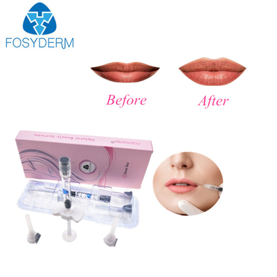 2ml Dermal Çapraz Bağlantılı Hyaluronik Kalem Dolgu Maddeleri