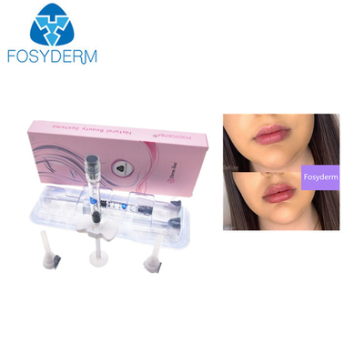 0.28mm HA Dermal Dolgu Maddeleri Hyaluronik Asit 1ml Dudak Enjeksiyonu