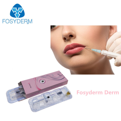 1ml 2ml Enjekte Edilebilir Çapraz Bağlantılı Dudak Dermal Dolgu Kırışıklık Kaldırma Enjeksiyonu
