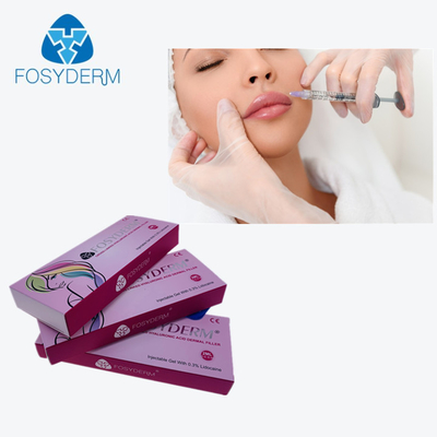 Çapraz Bağlantılı HA Dermal Dolgu 2Ml Derm, Enjekte Edilerek Dudakların İyileştirilmesini Sağlar