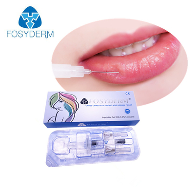 Dudak Hacmi İçin 2ml Enjekte Edilebilir BDDE Çapraz Bağlama Hyaluronik Asit Dolgu Enjeksiyonu