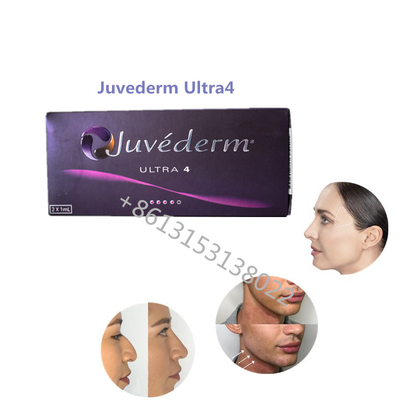 Dudak Dolgunluğu Juvederm Ultra4 Allergan Dermal Dolgu Juvederm HA Dudaklar İçin Dolgu Maddeleri