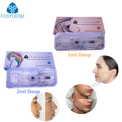 Dudaklar Yüz Cilt için Çapraz Bağlantılı Enjekte Hyaluronik Asit Jel Dermal Dolgu 1ml 2ml