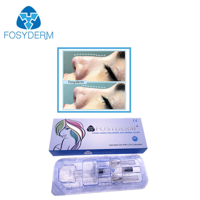 Lidokain ile 2 Ml Derin Çizgi Hyaluronik Asit Dermal Dolgu Burun Up