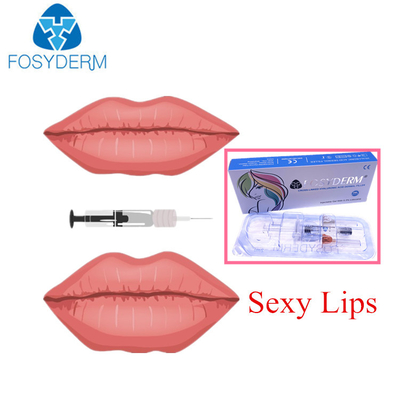 Dudak Dolgunluğu için Fosyderm Hyaluronik Asit Dermal Dolgu 2 Ml Derin Çizgi