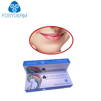 Smile Lines Hyaluronik Asit Dermal Dolgu Hacmi Derm Line Lyft Lidokain Dermal Dolgu Maddeleri