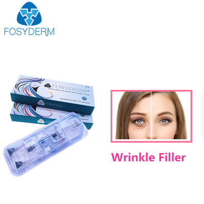 1.1 Ml Kırışıklıklar İçin Yüz Enjeksiyonları HA Dermal Dolgu