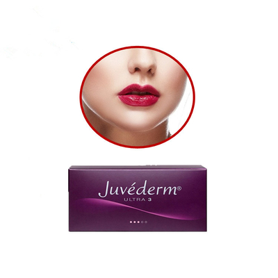 Juvederm Ultra 3 Hyaluronik Asit Dermal Dolgu Maddesi Lidokainli Rus Dudakları