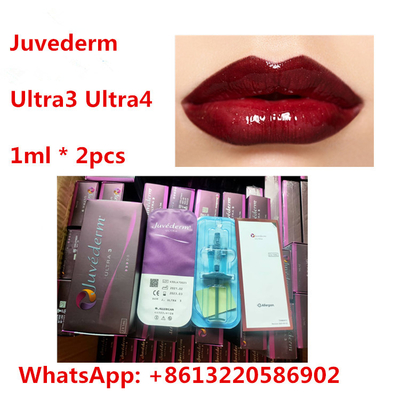 Lidokain Ultra3 Ultra4 ile Juvederm Dudak HA Dermal Dolgu