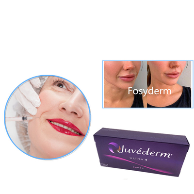 Juvederm Ultra 3 Ultra 4 Voluma HA Dermal Dolgu Jel Enjeksiyonu