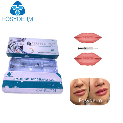 Dudaklar Burun Çene için 1ml Çapraz Bağlantılı Hyaluronik Asit Dermal Dolgu