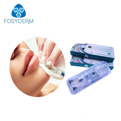 Dudak Enjekte Edilebilir 1.1ml İçin Hyaluronik Asit Jel Sodyum Dolgu