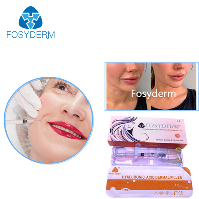 Dudakları Güçlendiren Kırışıklık Karşıtı İçin Çapraz Bağlantılı HA Dermal Dolgu