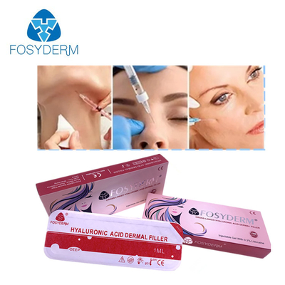 Dudak Dolgusu Yanak Kaldırıcı Yüz HA Dermal Dolgu Enjekte Edilebilir Fosyderm 2ml