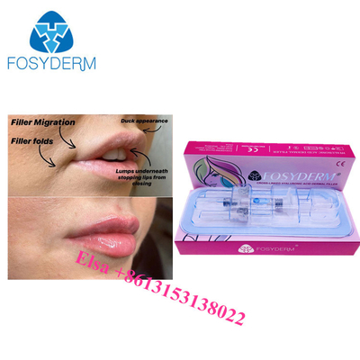 1 ml 2 ml 5 ml Enjeksiyonlar için Hyaluronik Asit